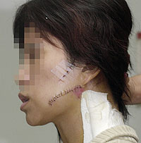 Lim's wife showing slash wounds